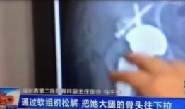 医生最新爆料新闻视频